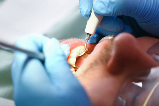 Best Emergency Care for Gum Disease in Cleveland, WI